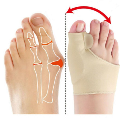 Corrector De Juanete